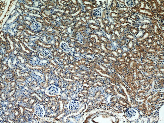 SEPX1 Antibody in Immunohistochemistry (Paraffin) (IHC (P))