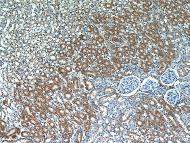 SEPX1 Antibody in Immunohistochemistry (Paraffin) (IHC (P))