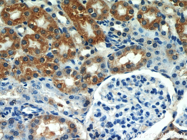 SEPX1 Antibody in Immunohistochemistry (Paraffin) (IHC (P))