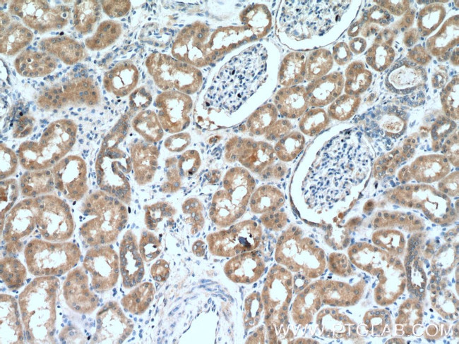 TSTA3 Antibody in Immunohistochemistry (Paraffin) (IHC (P))