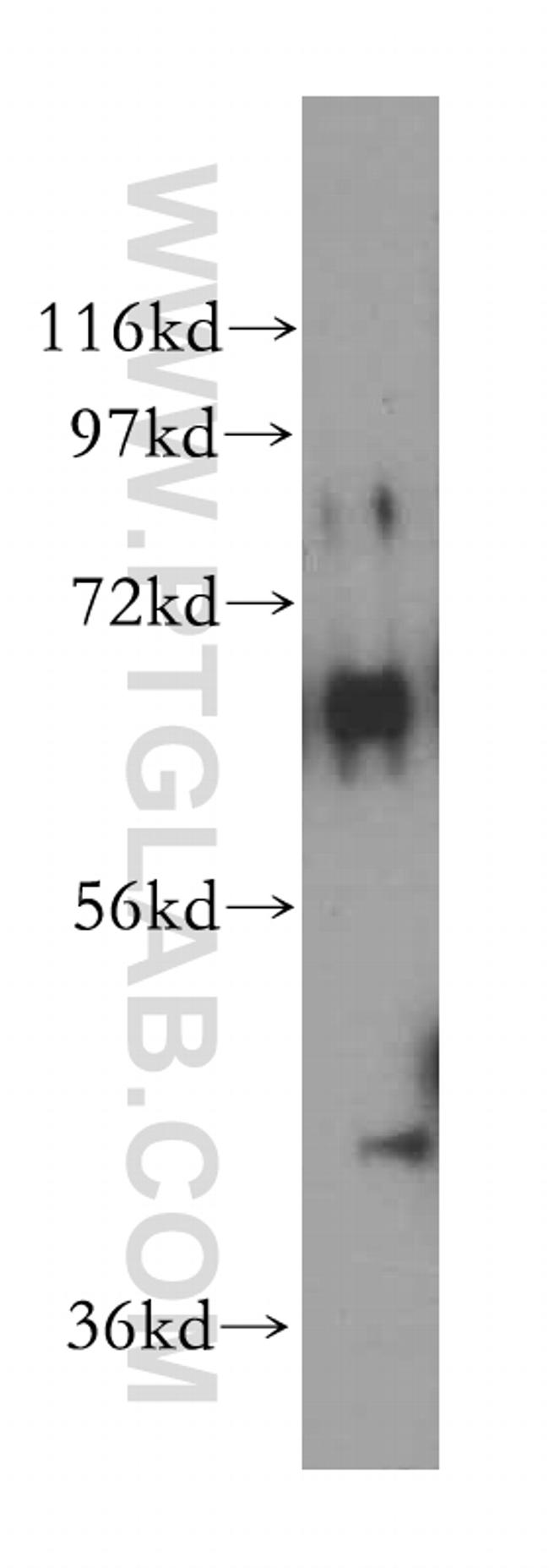 TSTA3 Antibody in Western Blot (WB)