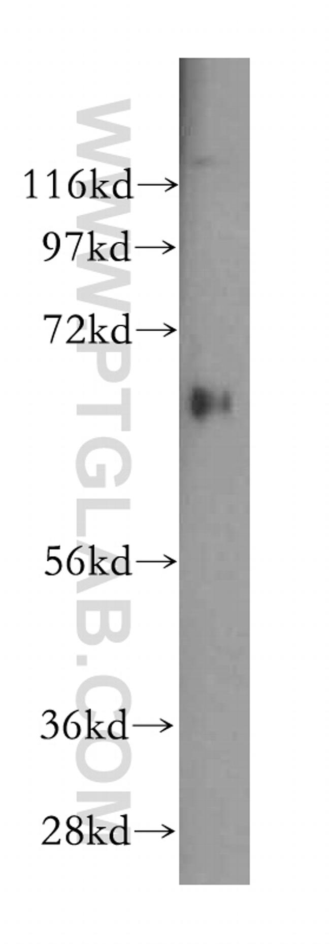 TSTA3 Antibody in Western Blot (WB)