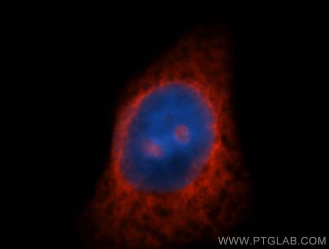 RPL7A Antibody in Immunocytochemistry (ICC/IF)