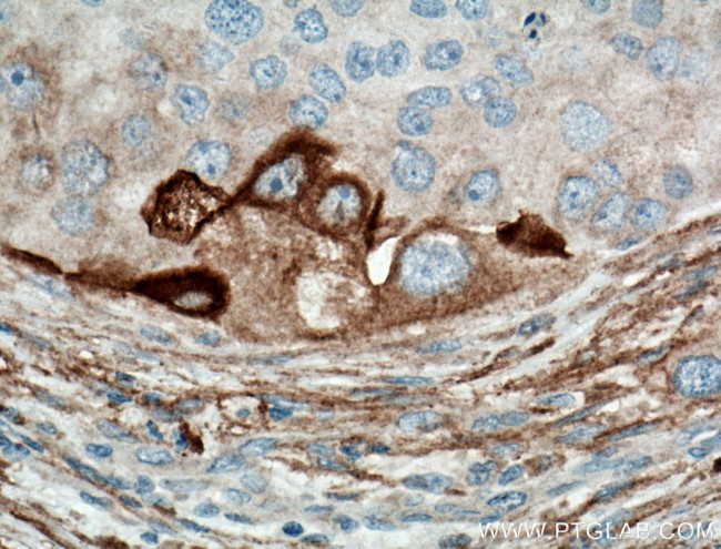 RPL7A Antibody in Immunohistochemistry (Paraffin) (IHC (P))