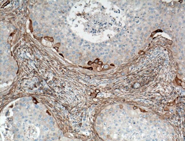 RPL7A Antibody in Immunohistochemistry (Paraffin) (IHC (P))