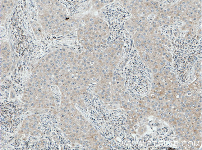 MRPL9 Antibody in Immunohistochemistry (Paraffin) (IHC (P))