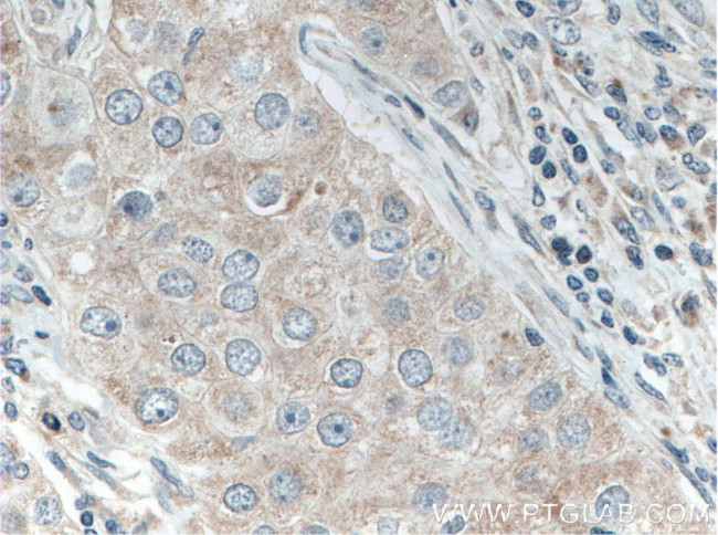 MRPL9 Antibody in Immunohistochemistry (Paraffin) (IHC (P))