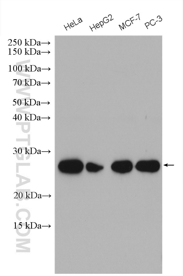 MRPL9 Antibody in Western Blot (WB)