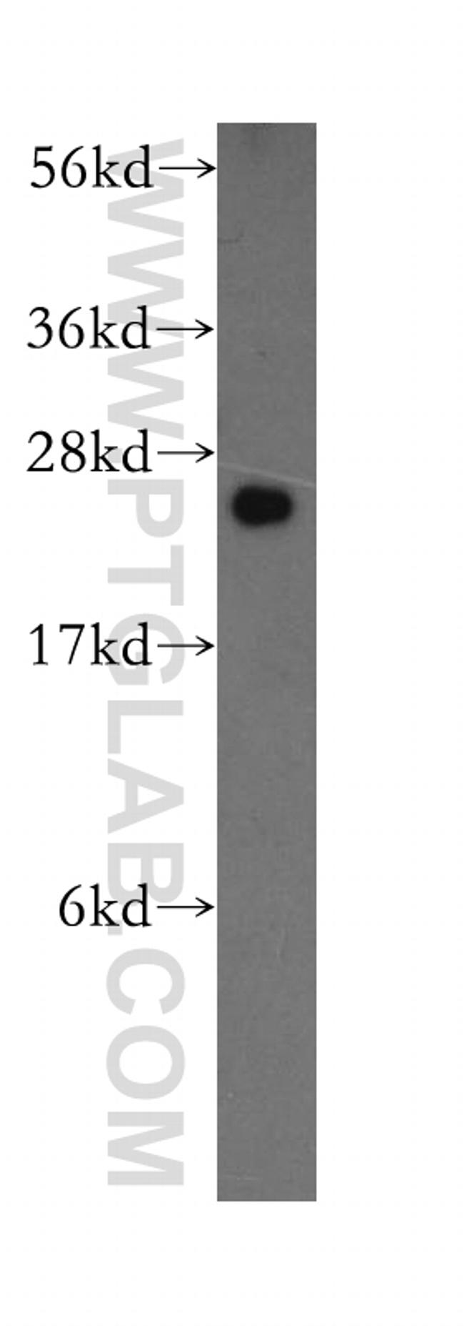 MRPL9 Antibody in Western Blot (WB)