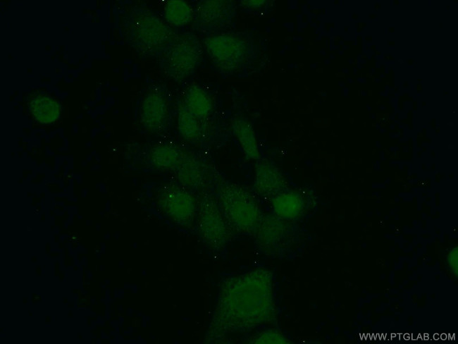 MAD2L1BP Antibody in Immunocytochemistry (ICC/IF)