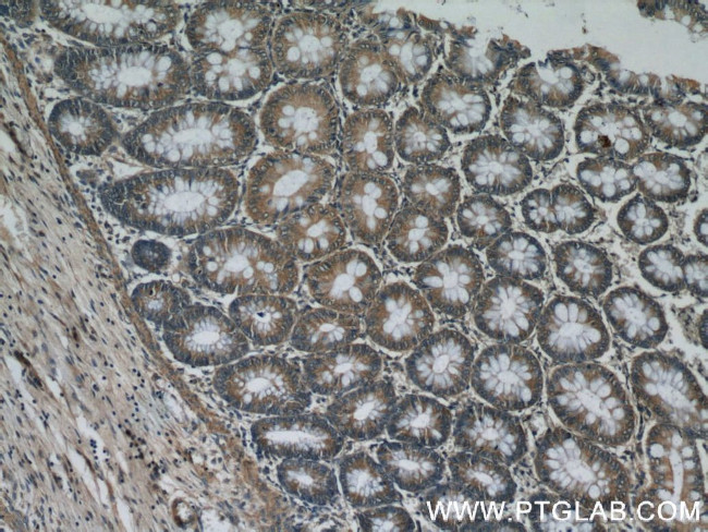 MAD2L1BP Antibody in Immunohistochemistry (Paraffin) (IHC (P))