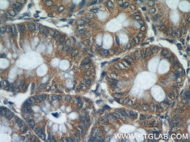 MAD2L1BP Antibody in Immunohistochemistry (Paraffin) (IHC (P))