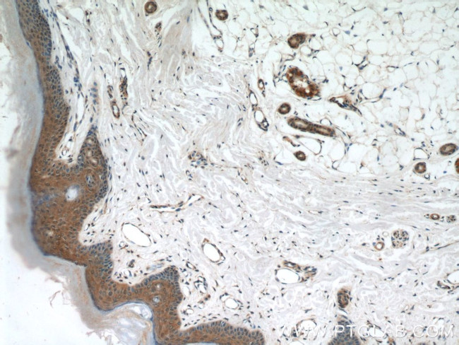 MAD2L1BP Antibody in Immunohistochemistry (Paraffin) (IHC (P))