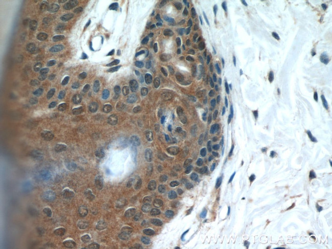 MAD2L1BP Antibody in Immunohistochemistry (Paraffin) (IHC (P))