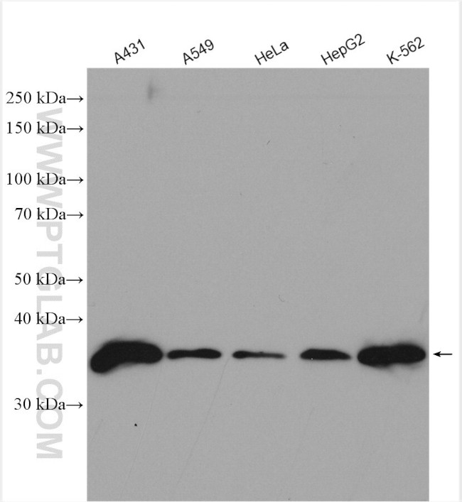 MAD2L1BP Antibody in Western Blot (WB)