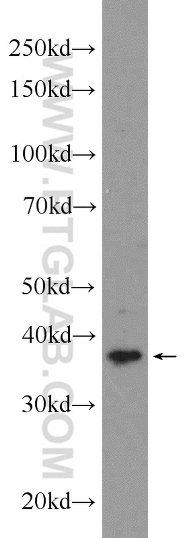 CKMT1A Antibody in Western Blot (WB)