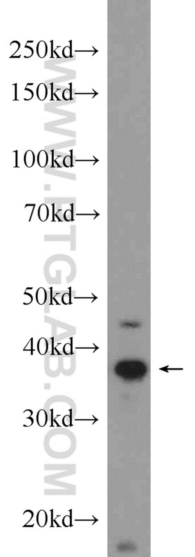 CKMT1A Antibody in Western Blot (WB)