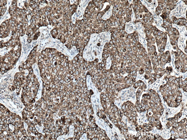 CKMT1A Antibody in Immunohistochemistry (Paraffin) (IHC (P))