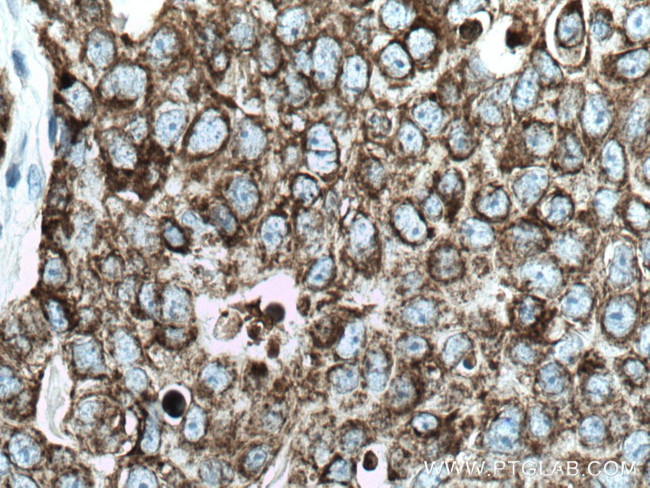 CKMT1A Antibody in Immunohistochemistry (Paraffin) (IHC (P))