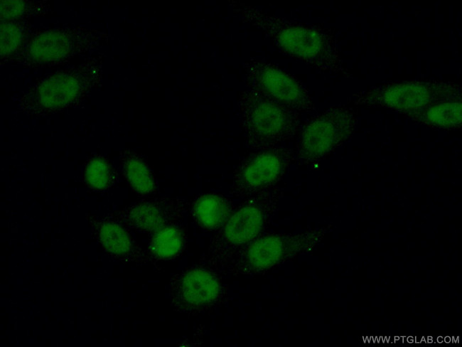 UBA2 Antibody in Immunocytochemistry (ICC/IF)