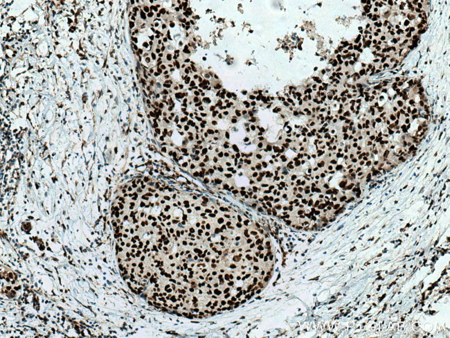 UBA2 Antibody in Immunohistochemistry (Paraffin) (IHC (P))