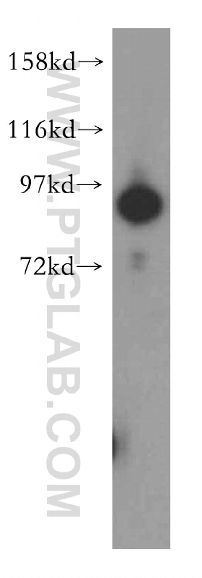 UBA2 Antibody in Western Blot (WB)