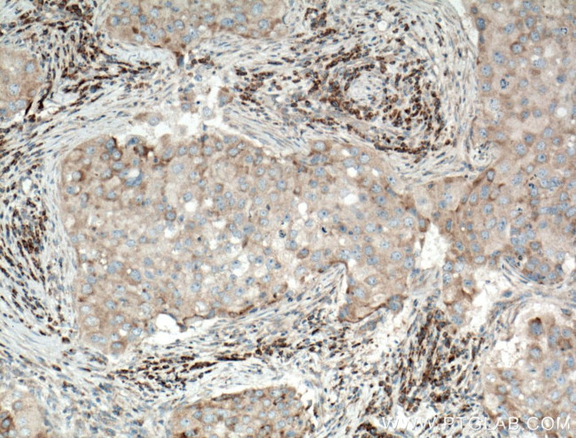 PA2G4 Antibody in Immunohistochemistry (Paraffin) (IHC (P))