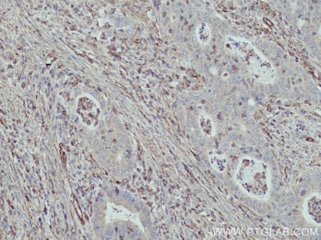 MYL9 Antibody in Immunohistochemistry (Paraffin) (IHC (P))