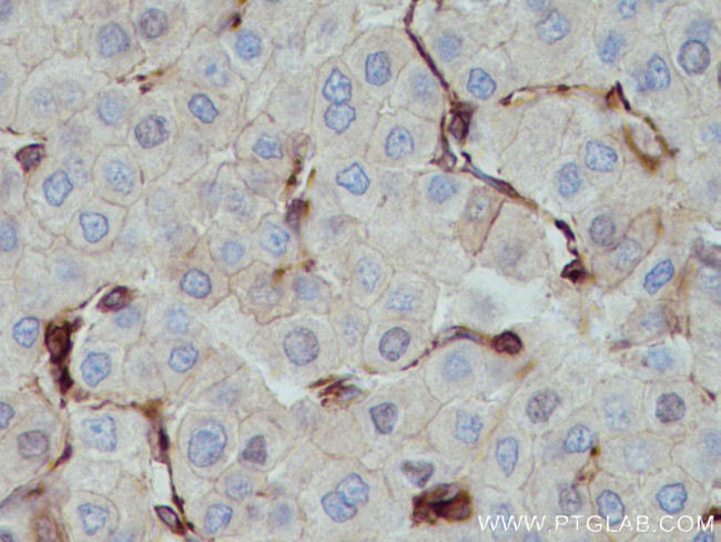 MYL9 Antibody in Immunohistochemistry (Paraffin) (IHC (P))