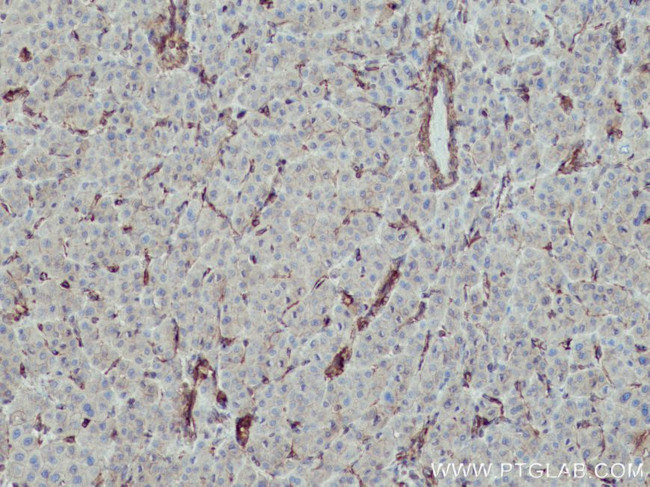 MYL9 Antibody in Immunohistochemistry (Paraffin) (IHC (P))