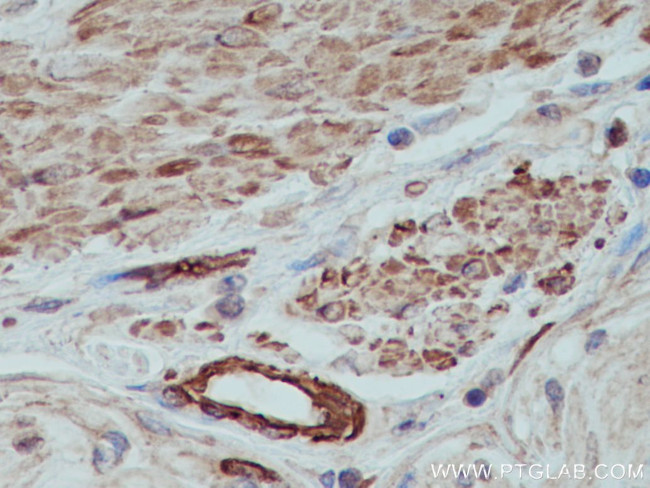 MYL9 Antibody in Immunohistochemistry (Paraffin) (IHC (P))