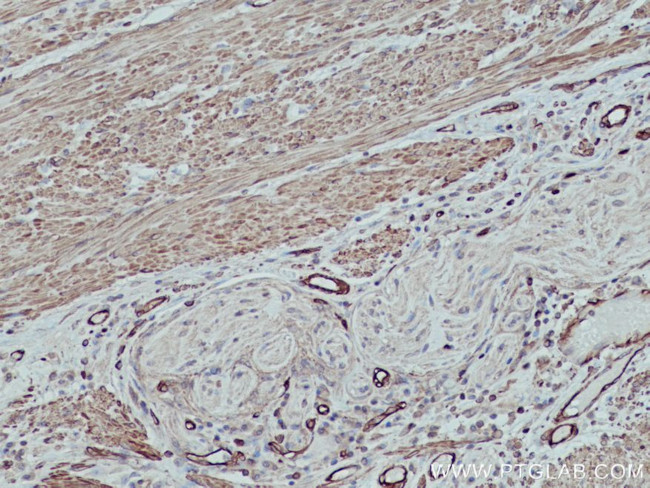 MYL9 Antibody in Immunohistochemistry (Paraffin) (IHC (P))