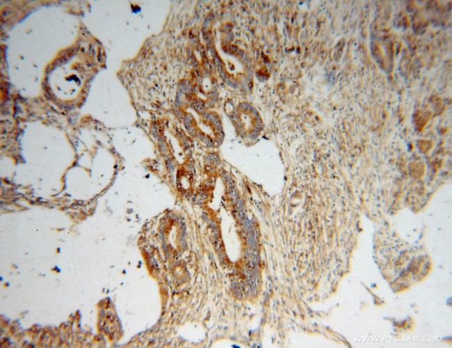 MYL9 Antibody in Immunohistochemistry (Paraffin) (IHC (P))