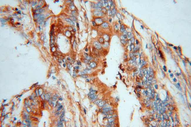 MYL9 Antibody in Immunohistochemistry (Paraffin) (IHC (P))