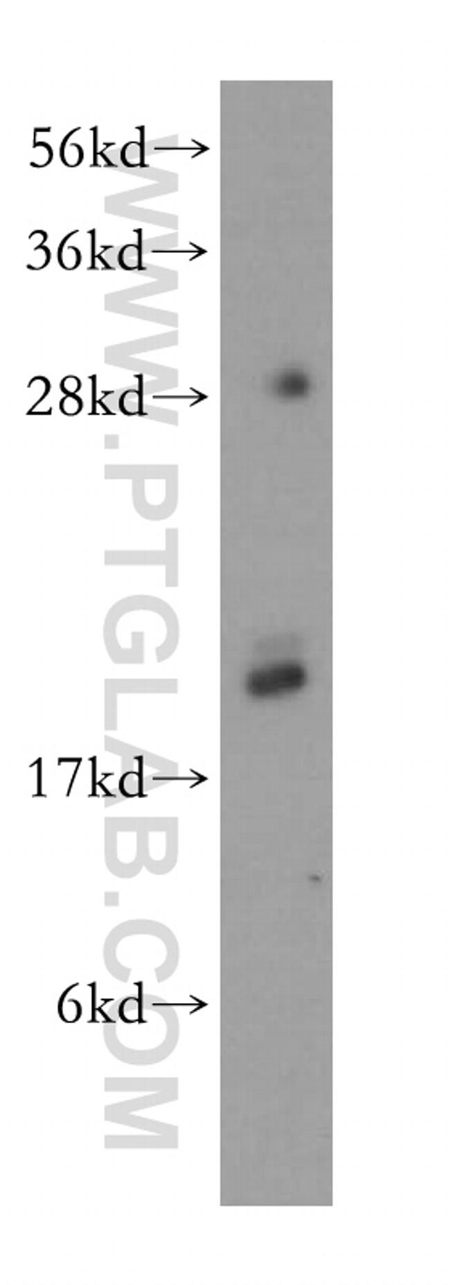 MYL9 Antibody in Western Blot (WB)