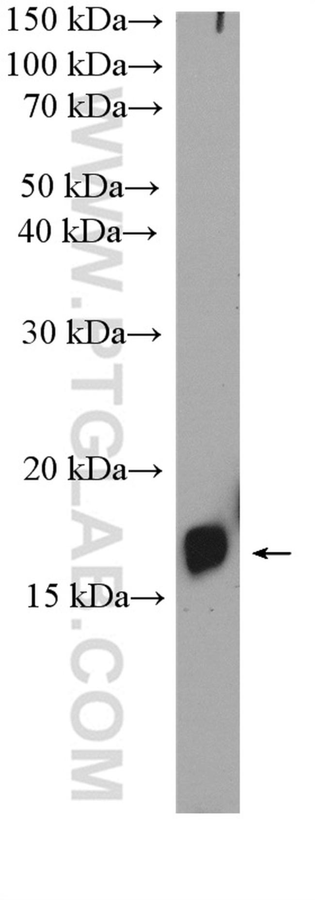 MYL9 Antibody in Western Blot (WB)