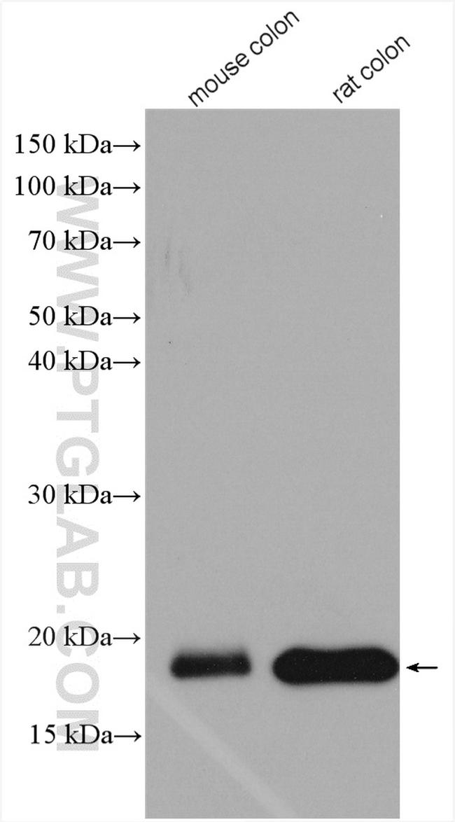 MYL9 Antibody in Western Blot (WB)