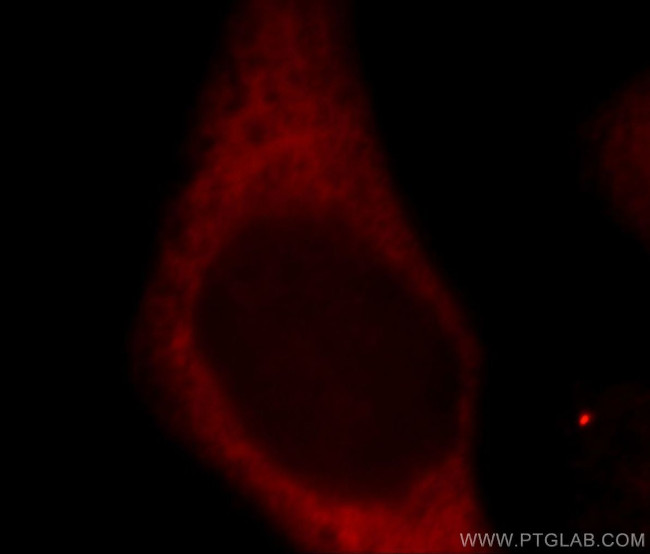 RPS27 Antibody in Immunocytochemistry (ICC/IF)