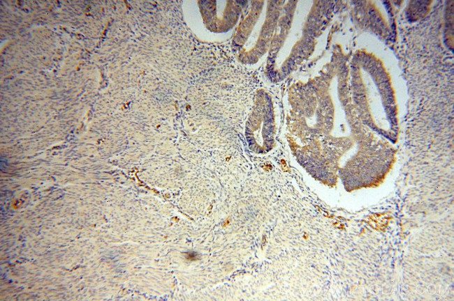 RPS27 Antibody in Immunohistochemistry (Paraffin) (IHC (P))