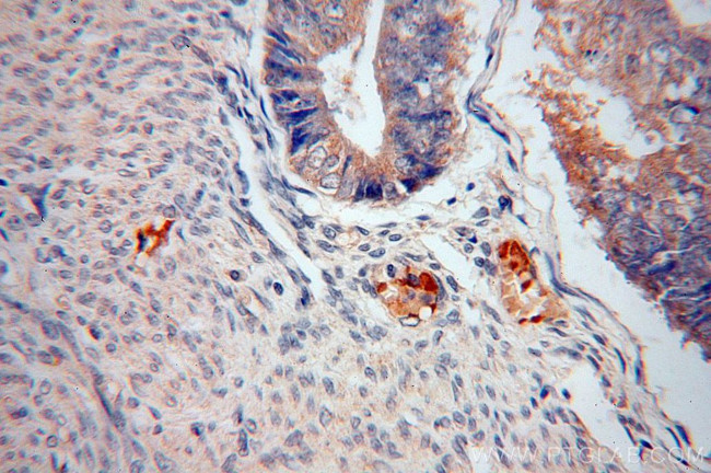 RPS27 Antibody in Immunohistochemistry (Paraffin) (IHC (P))