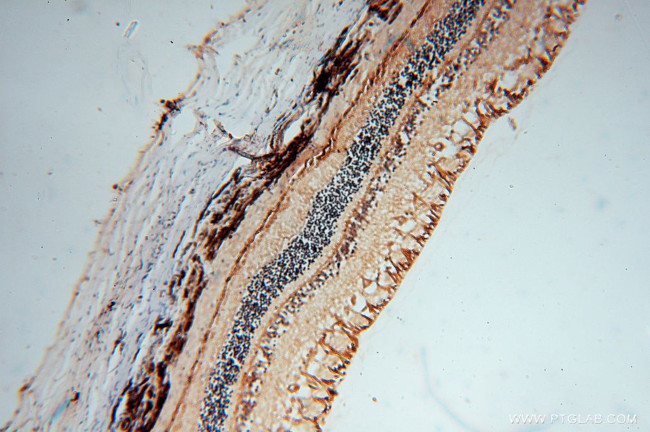 RLBP1 Antibody in Immunohistochemistry (Paraffin) (IHC (P))