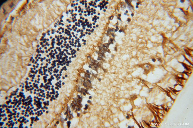 RLBP1 Antibody in Immunohistochemistry (Paraffin) (IHC (P))