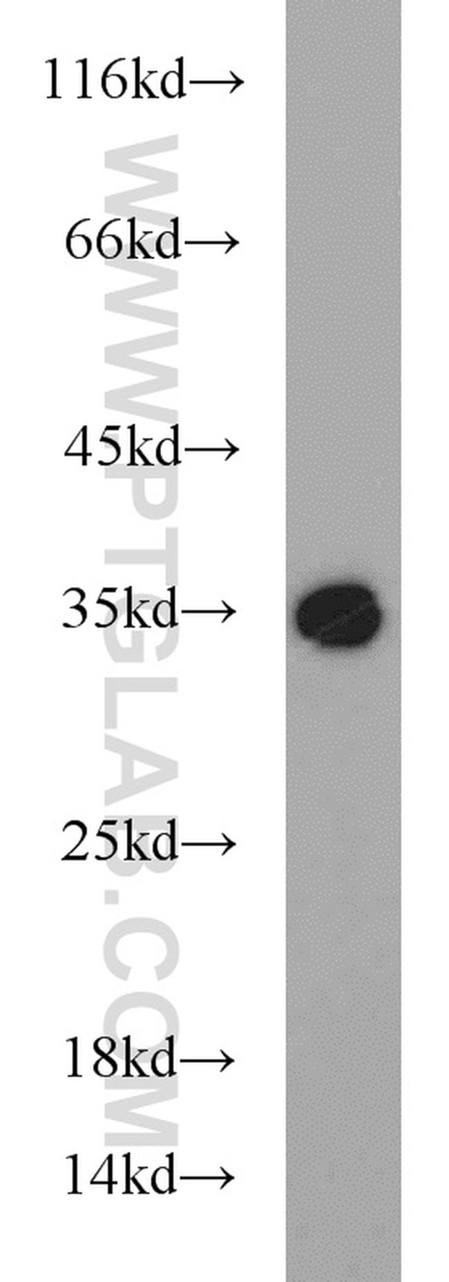 RLBP1 Antibody in Western Blot (WB)