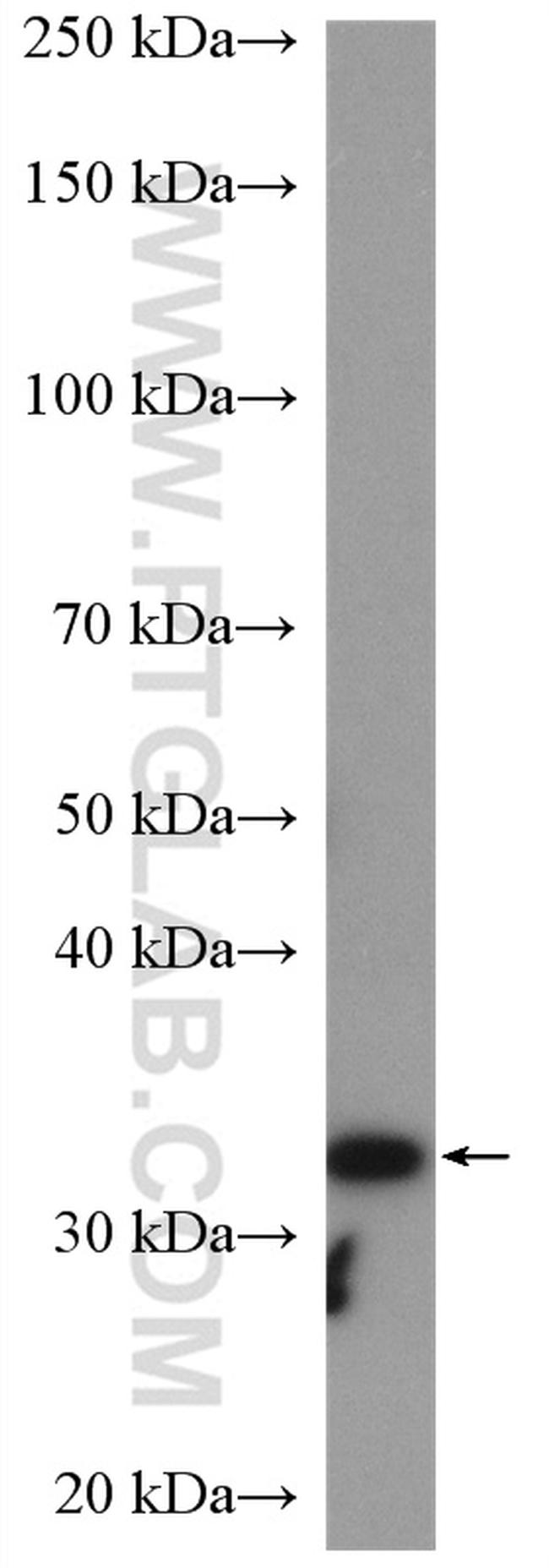 RLBP1 Antibody in Western Blot (WB)