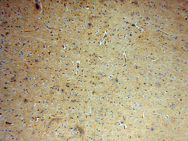 SNUPN Antibody in Immunohistochemistry (Paraffin) (IHC (P))