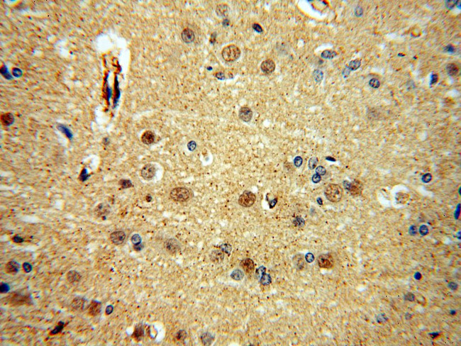 SNUPN Antibody in Immunohistochemistry (Paraffin) (IHC (P))