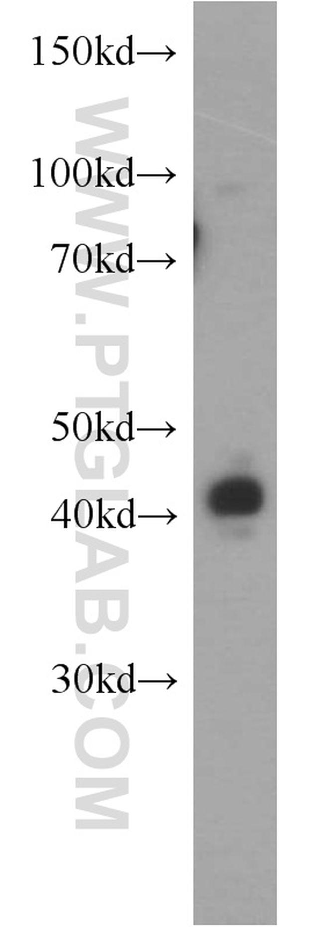 SNUPN Antibody in Western Blot (WB)