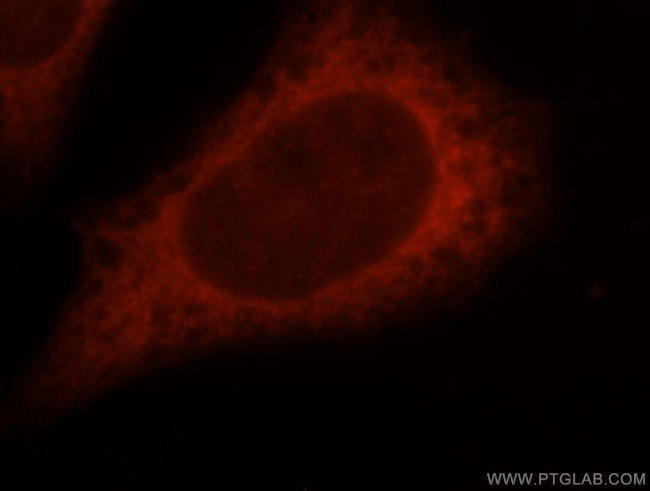 DTYMK Antibody in Immunocytochemistry (ICC/IF)