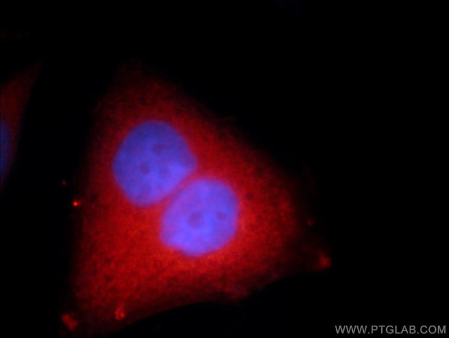 DTYMK Antibody in Immunocytochemistry (ICC/IF)