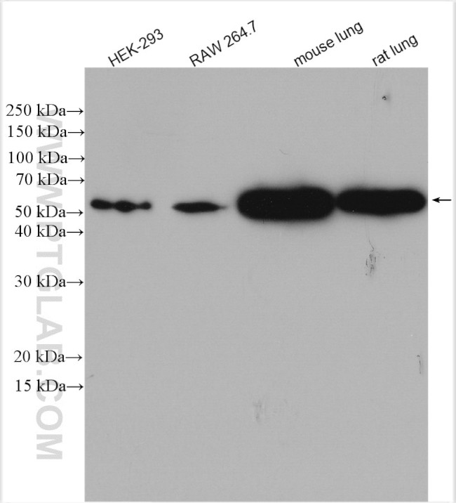 beta Arrestin 1 Antibody in Western Blot (WB)